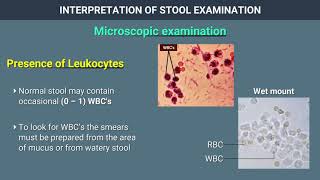 Interpretation of Stool Examination [upl. by Blockus]