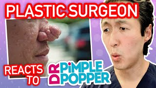 Plastic Surgeon Reacts to DR PIMPLE POPPER Terrible Nose Rhinophyma [upl. by Yelena199]