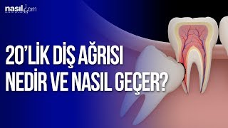 20lik diş ağrısı nedir ve nasıl geçer  Sağlık  Nasilcom [upl. by Ellora]