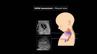 Fetal Echocardiography Protocol and Technique [upl. by Atinaj]