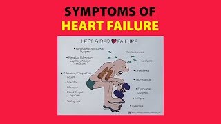 Symptoms of Heart Failure [upl. by Mirabella110]