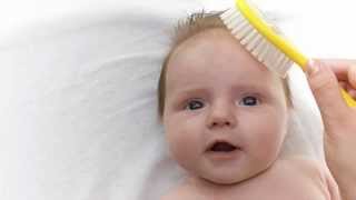 Cradle Cap  Boys Town Pediatrics [upl. by Edouard]