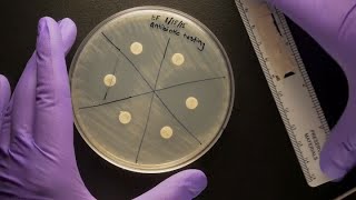 ID Laboratory Videos Antibiotic susceptibility testing [upl. by Eradis166]