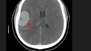 High Yield CT Scans Part 2  USMLE [upl. by Hutchings645]