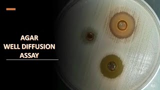 Agar well diffusion assay [upl. by Hameerak]