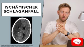 Ischämischer Schlaganfall  Grundlagen der Neurologie [upl. by Anairda]