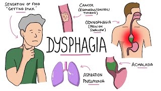 What Is Aerophagia And What Can I Do  Malibu  Thousand Oaks  Westlake Village  Dr Ronald Popper [upl. by Atul924]