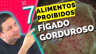 FÍGADO GORDUROSO 7 ALIMENTOS PROIBIDOS PARA GORDURA NO FÍGADO SINTOMAS DA ESTEATOSE HEPÁTICA [upl. by Neomah]