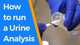 How to run a Urine Analysis [upl. by Minsat]