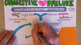 Congestive Heart Failure Pathophysiology [upl. by Nnylsaj]